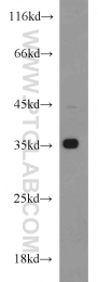 18736-1-AP - HOXD13 / HOX4I