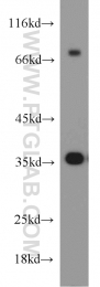 18736-1-AP - HOXD13 / HOX4I