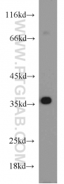18736-1-AP - HOXD13 / HOX4I