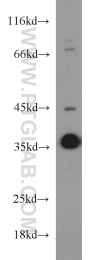 18736-1-AP - HOXD13 / HOX4I