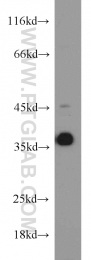 18736-1-AP - HOXD13 / HOX4I