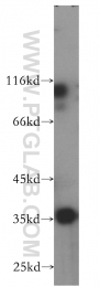 18736-1-AP - HOXD13 / HOX4I
