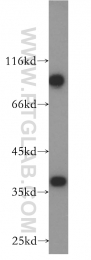 18736-1-AP - HOXD13 / HOX4I