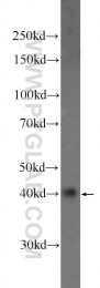 23520-1-AP - HOXD13 / HOX4I