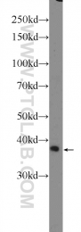 23520-1-AP - HOXD13 / HOX4I