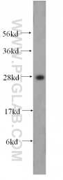 17780-1-AP - HOXD4 / HOX4B