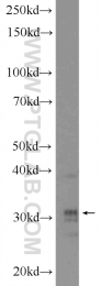 18588-1-AP - HOXD8 / HOX4E