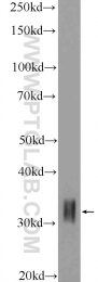 18588-1-AP - HOXD8 / HOX4E