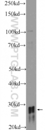 18588-1-AP - HOXD8 / HOX4E