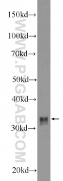 18588-1-AP - HOXD8 / HOX4E