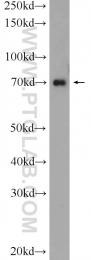 24556-1-AP - HP1BP3