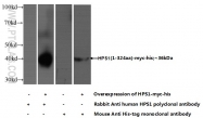 15077-1-AP - HPS1
