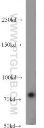 15077-1-AP - HPS1