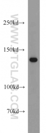13901-1-AP - HPS5 / AIBP63