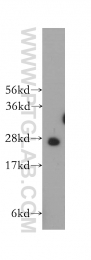 12453-1-AP - HS2ST1 / 2OST