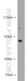 10169-2-AP - HSBP1 / HSF1BP