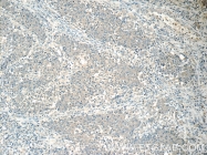 15132-1-AP - HSCB / DNAJC20 / HSC20