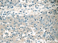 15132-1-AP - HSCB / DNAJC20 / HSC20