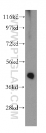 15516-1-AP - 3-beta HSD2 / HSD3B2