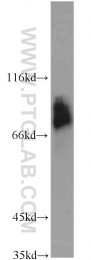 51034-1-AP - Heat shock factor 1 / HSF1
