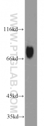 51034-1-AP - Heat shock factor 1 / HSF1