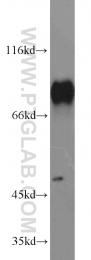 51034-1-AP - Heat shock factor 1 / HSF1