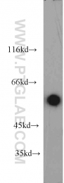 18797-1-AP - Heat shock factor 4 / HSF4