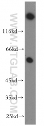 18797-1-AP - Heat shock factor 4 / HSF4
