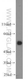 18797-1-AP - Heat shock factor 4 / HSF4