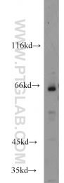 17765-1-AP - Heat shock factor 5 / HSF5