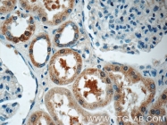 24055-1-AP - Protein HSN2