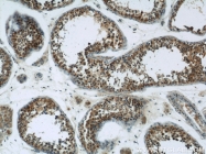13383-1-AP - Heat shock protein 105 / HSP105