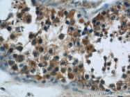 13383-1-AP - Heat shock protein 105 / HSP105