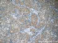 13383-1-AP - Heat shock protein 105 / HSP105