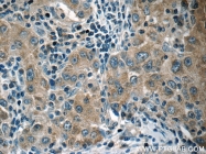 13383-1-AP - Heat shock protein 105 / HSP105
