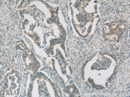 13383-1-AP - Heat shock protein 105 / HSP105