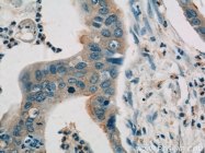 13383-1-AP - Heat shock protein 105 / HSP105