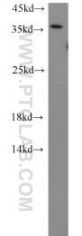 15775-1-AP - HTRA2 / PRSS25