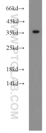15775-1-AP - HTRA2 / PRSS25