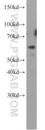 15115-1-AP - HYAL2 / Hyaluronidase-2