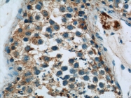 18139-1-AP - HYAL4 / Hyaluronidase-4