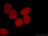 17168-1-AP - Histone H3.2