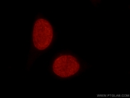 17168-1-AP - Histone H3.2