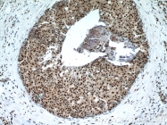 17168-1-AP - Histone H3.2