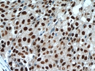 17168-1-AP - Histone H3.2