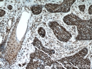 17168-1-AP - Histone H3.2