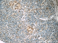 11910-1-AP - ELAVL1 / HUR