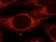 17170-1-AP - Isoleucyl-tRNA synthetase / IARS2
