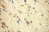 17170-1-AP - Isoleucyl-tRNA synthetase / IARS2