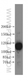 17170-1-AP - Isoleucyl-tRNA synthetase / IARS2